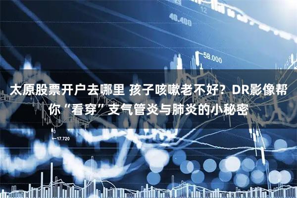 太原股票开户去哪里 孩子咳嗽老不好？DR影像帮你“看穿”支气管炎与肺炎的小秘密